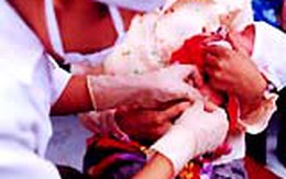 Không tiêm chủng khi trẻ sốt